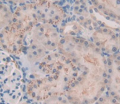 Fas Activated Serine/Threonine Kinase (FASTK) Rat Polyclonal Antibody