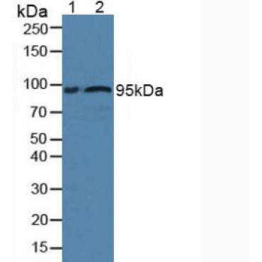 Fibulin 1 (FBLN1) Human Polyclonal Antibody