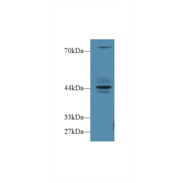 Fibrosin (FBS) Human Polyclonal Antibody