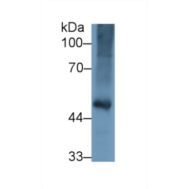 Fibrinogen Gamma (FGg) Chicken (Gallus) Polyclonal Antibody