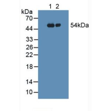 Fibrinogen Gamma (FGg) Human Polyclonal Antibody