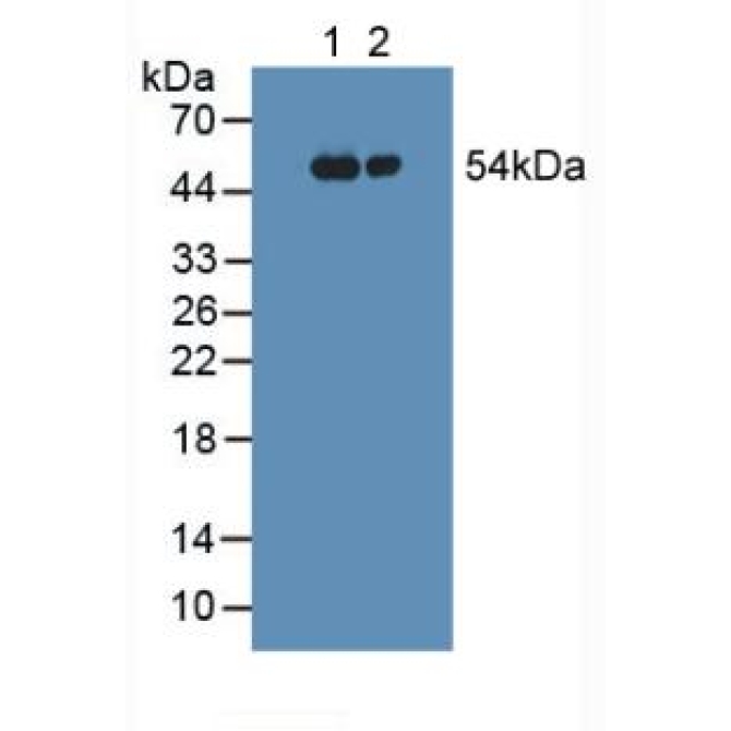 Fibrinogen Gamma (FGg) Human Polyclonal Antibody