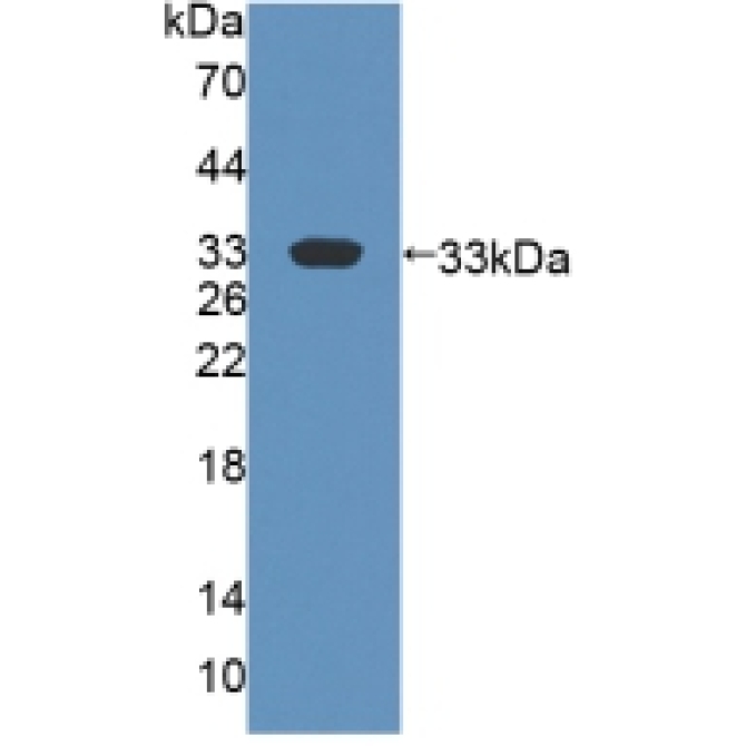 Flavin Containing Monooxygenase 2, Non Functional (FMO2) Human Polyclonal Antibody