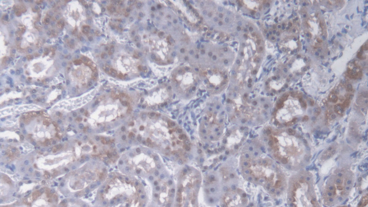Flavin Containing Monooxygenase 2, Non Functional (FMO2) Rat Polyclonal Antibody