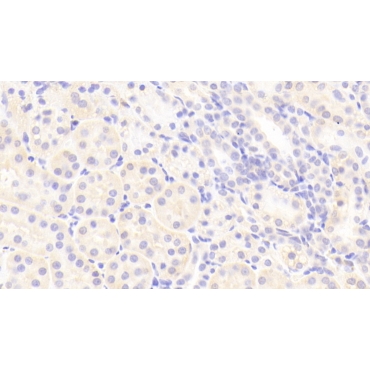 Fucose-1-Phosphate Guanylyltransferase (FPGT) Human Polyclonal Antibody