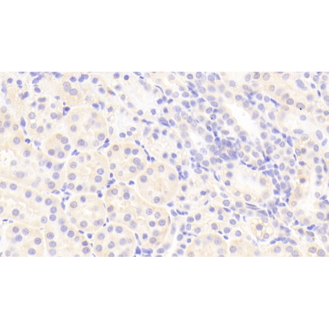 Fucose-1-Phosphate Guanylyltransferase (FPGT) Human Polyclonal Antibody