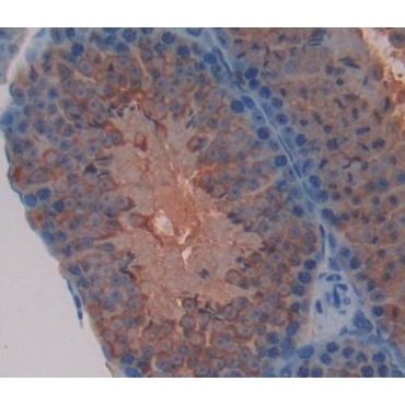 Follicular Lymphoma Variant Translocation 1 (FVT1) Mouse Polyclonal Antibody