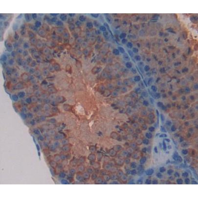 Follicular Lymphoma Variant Translocation 1 (FVT1) Mouse Polyclonal Antibody