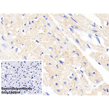 Ferrochelatase (FECH) Human Polyclonal Antibody