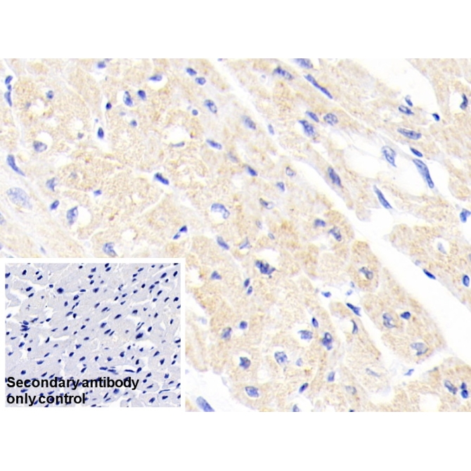 Ferrochelatase (FECH) Human Polyclonal Antibody