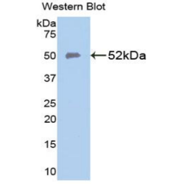 Ferroportin (FPN) Human Polyclonal Antibody