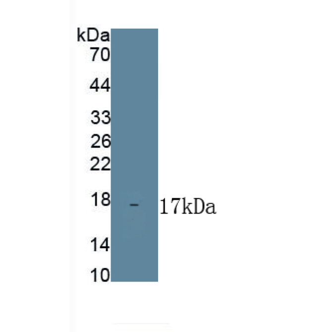 Ferroportin (FPN) Mouse Polyclonal Antibody