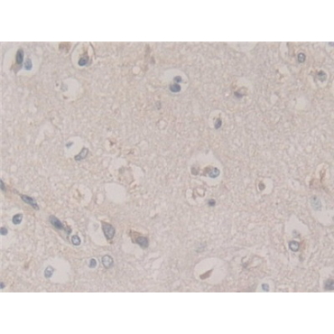 Frataxin (FXN) Human Polyclonal Antibody