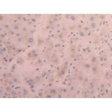 Furin (FUR) Human Polyclonal Antibody