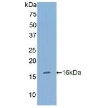 Furin (FUR) Human Polyclonal Antibody