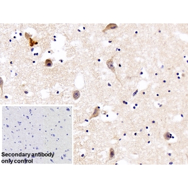 Furin (FUR) Human Polyclonal Antibody