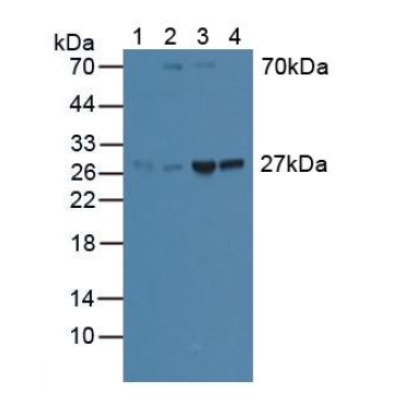 Guanidinoacetate-N-Methyltransferase (GAMT) Human Polyclonal Antibody