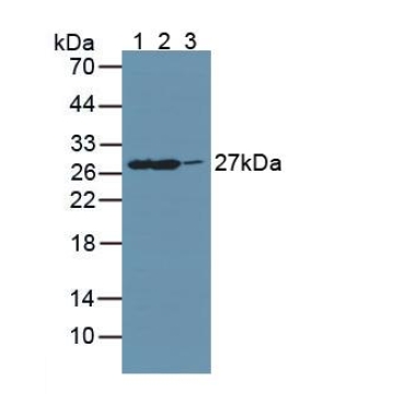 Guanidinoacetate-N-Methyltransferase (GAMT) Mouse Polyclonal Antibody