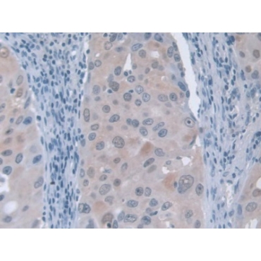 G-Elongation Factor, Mitochondrial 1 (GFM1) Human Polyclonal Antibody
