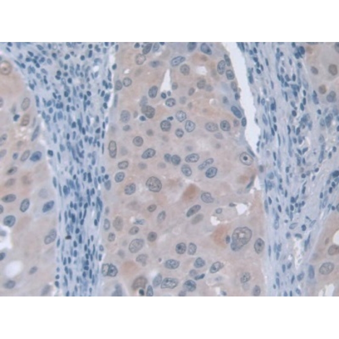 G-Elongation Factor, Mitochondrial 1 (GFM1) Human Polyclonal Antibody