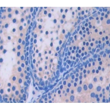 Geranylgeranyl Diphosphate Synthase 1 (GGPS1) Mouse Polyclonal Antibody