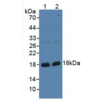 Gastrokine 1 (GKN1) Human Polyclonal Antibody