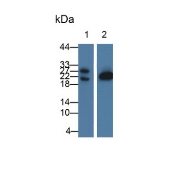 Glycolipid Transfer Protein (GLTP) Human Polyclonal Antibody