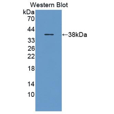 Glycophorin E (GYPE) Human Polyclonal Antibody