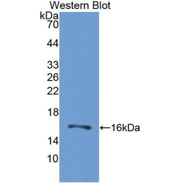 Gastrin Releasing Peptide Receptor (GRPR) Human Polyclonal Antibody