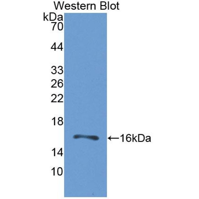 Gastrin Releasing Peptide Receptor (GRPR) Human Polyclonal Antibody