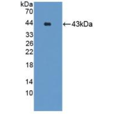 Gastrin Releasing Peptide Receptor (GRPR) Mouse Polyclonal Antibody