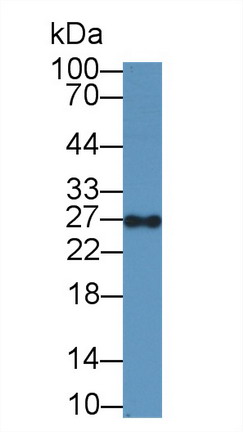 Geminin (GMNN) Human Polyclonal Antibody