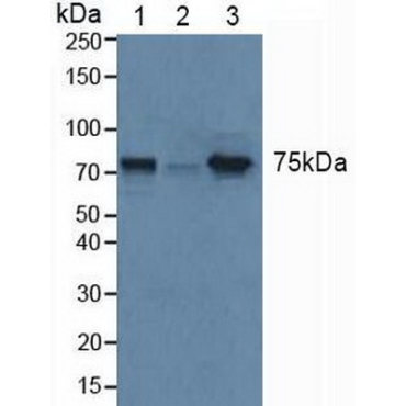 Glucocerebrosidase (GBA) Human Polyclonal Antibody