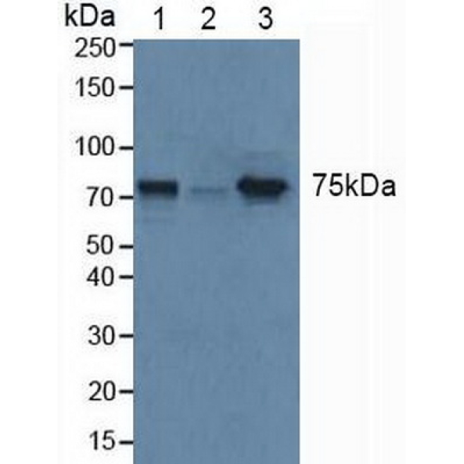 Glucocerebrosidase (GBA) Human Polyclonal Antibody
