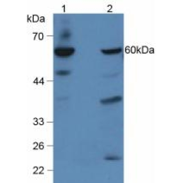 Glucocerebrosidase (GBA) Human Polyclonal Antibody