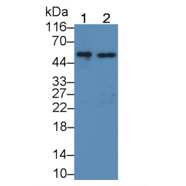 Glucocerebrosidase (GBA) Human Polyclonal Antibody