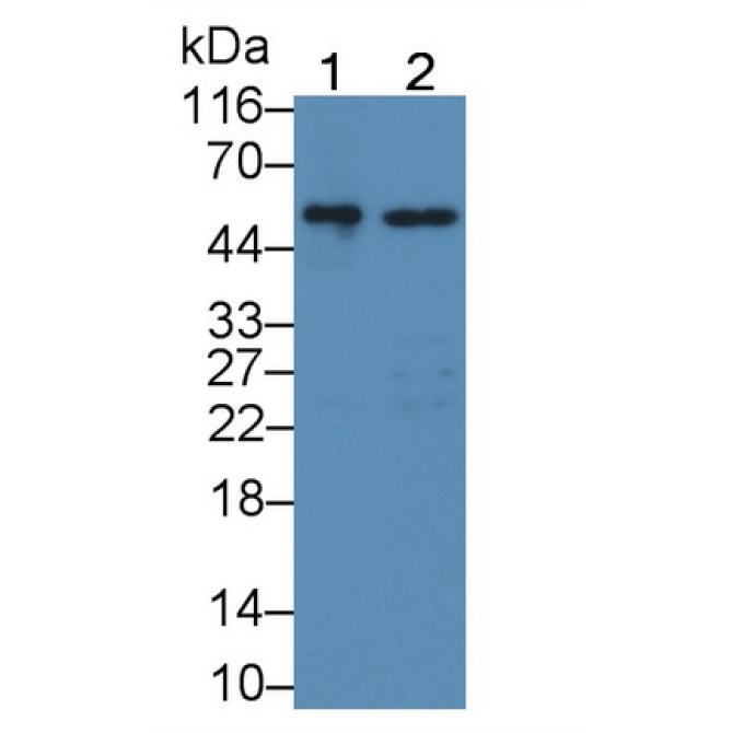 Glucocerebrosidase (GBA) Human Polyclonal Antibody