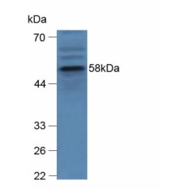 Glucocerebrosidase (GBA) Mouse Polyclonal Antibody