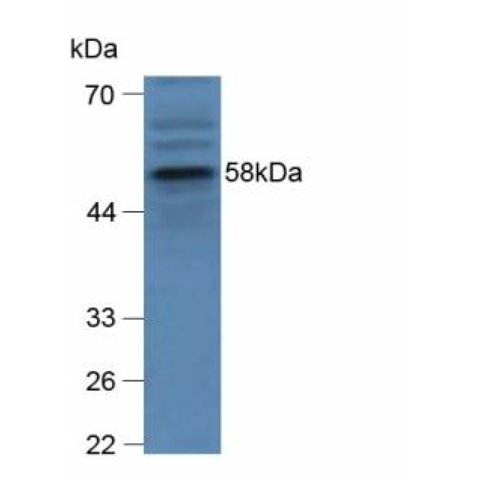 Glucocerebrosidase (GBA) Mouse Polyclonal Antibody