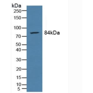 Prostate-specific Membrane Antigen (PMSA) Human Polyclonal Antibody