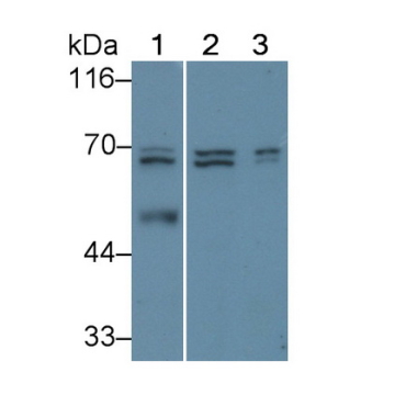 Granulin (GRN) Human Polyclonal Antibody