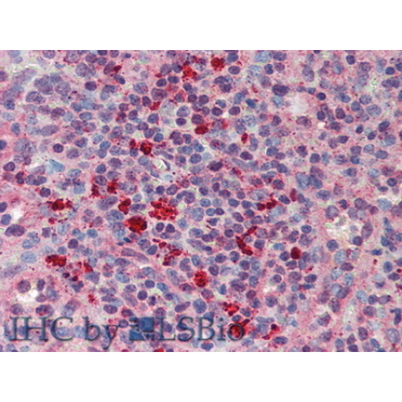 Granulin (GRN) Human Polyclonal Antibody