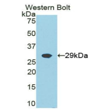 Growth Factor Receptor Bound Protein 2 (Grb2) Human Polyclonal Antibody