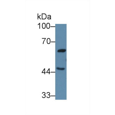 Growth Hormone Releasing Hormone Receptor (GHRHR) Human Polyclonal Antibody