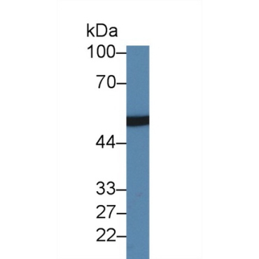 Hyaluronan Binding Protein 2 (HABP2) Human Polyclonal Antibody