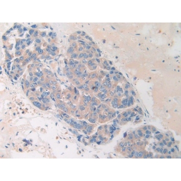 Heart And Neural Crest Derivatives Expressed Protein 1 (HAND1) Human Polyclonal Antibody