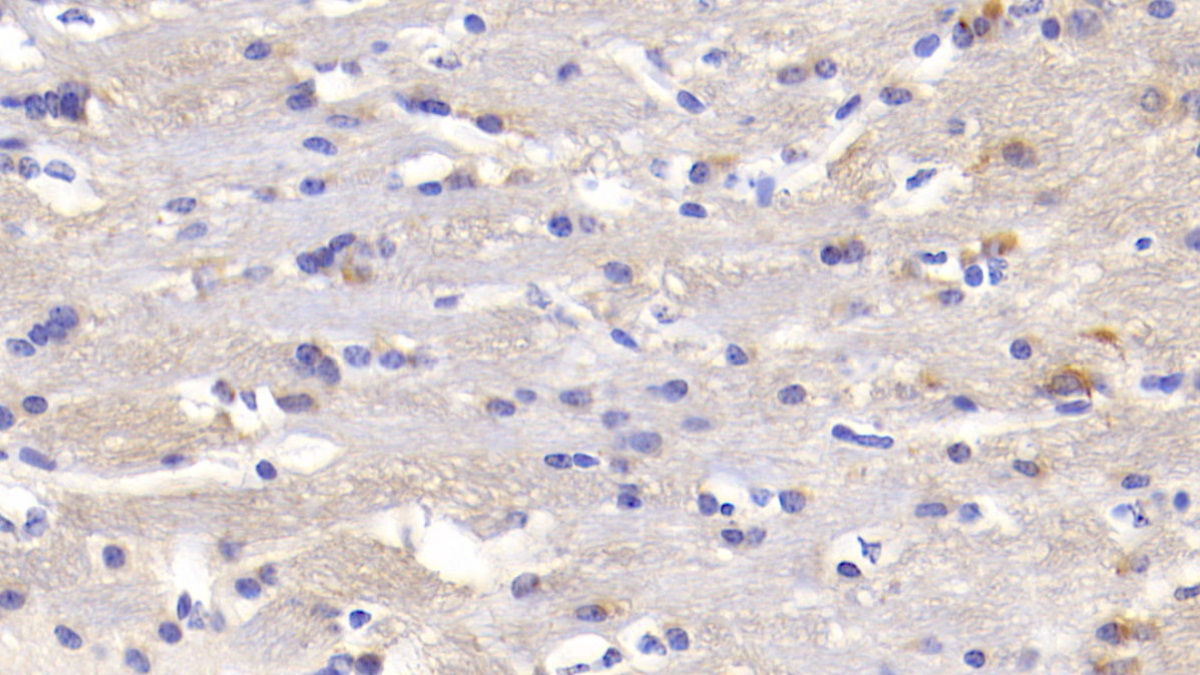 Heart And Neural Crest Derivatives Expressed Protein 1 (HAND1) Mouse Polyclonal Antibody