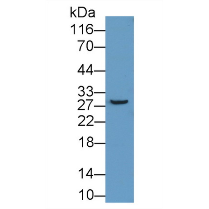 ATP Binding Cassette Transporter A12 (ABCA12) Human Polyclonal Antibody