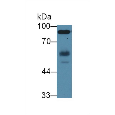 Hemopoietic Cell Kinase (HCK) Human Polyclonal Antibody