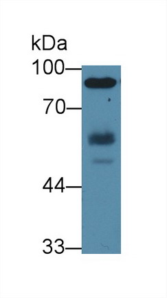 Hemopoietic Cell Kinase (HCK) Human Polyclonal Antibody